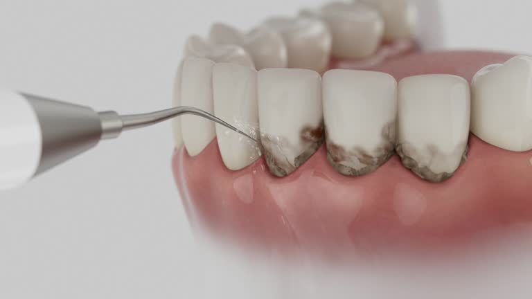 Trusted Dental Implants service in Commerce, TX - Dentist Open Now